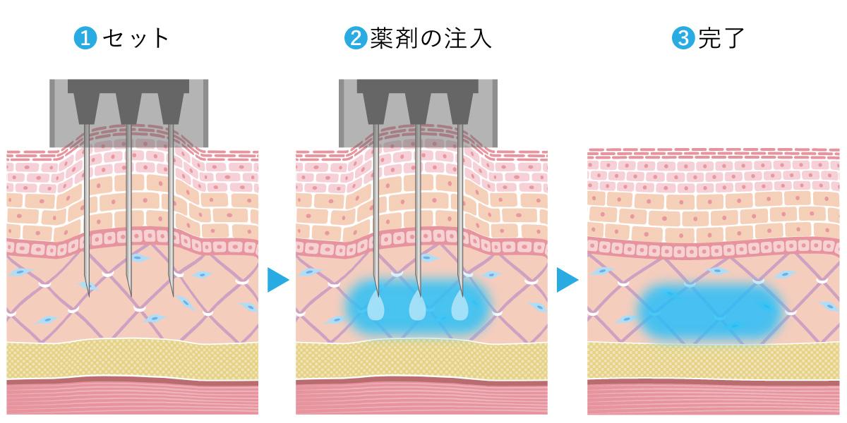 臨床光皮膚科学 光皮膚科学 / 堀尾 武【著】 - 紀伊國屋書店ウェブストア