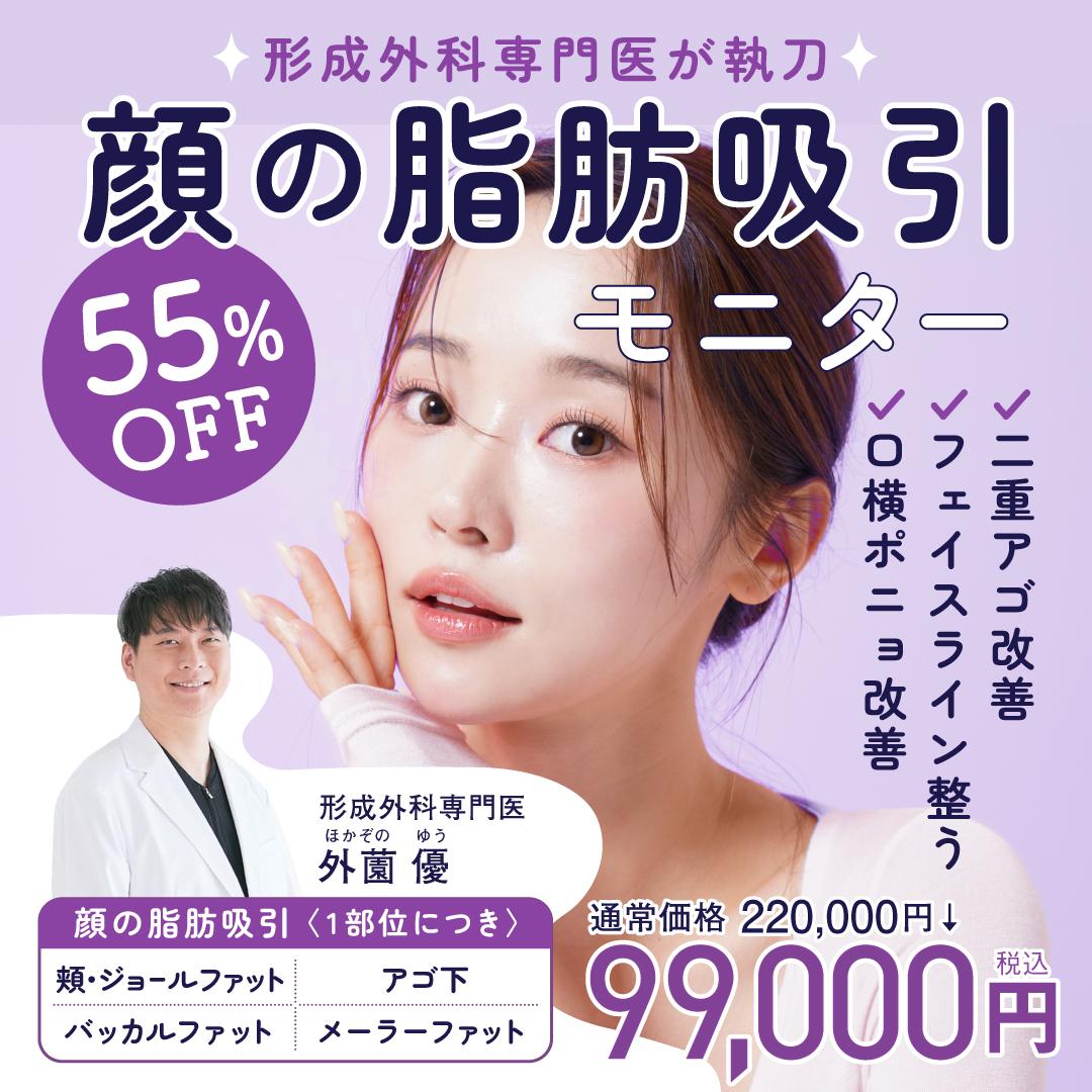 顔の脂肪吸引モニター