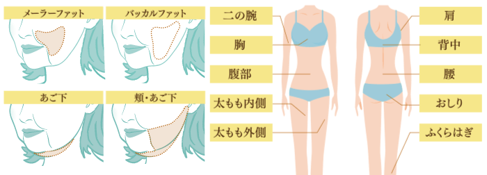 人気のお腹周り、太もも・おしり、二の腕やお顔も、どんな部位の脂肪吸引も可能です。
