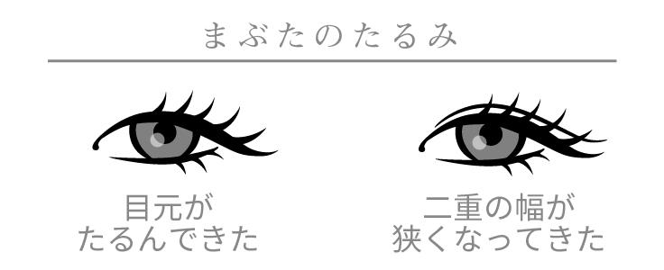 加齢によるまぶたの皮膚のたるみには、『二重埋没法』や『全切開二重まぶた法』が適しています。「まぶたが開けにくい」場合は、眼瞼下垂の可能性がありますので、医師にご相談ください。