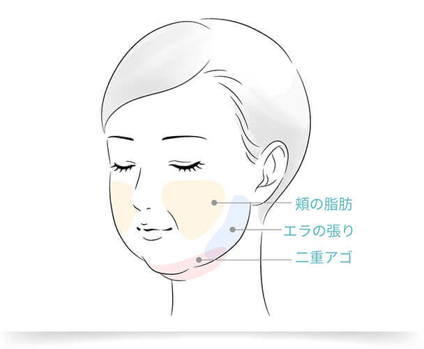 フェイスラインから耳の下のエラ張り、落ちにくい頬の脂肪やフェイスラインのゆるみ、二重アゴや四角い形のアゴ、梅干シワの原因となる「オトガイ筋」の肥大など顔が大きく見える原因は様々です
