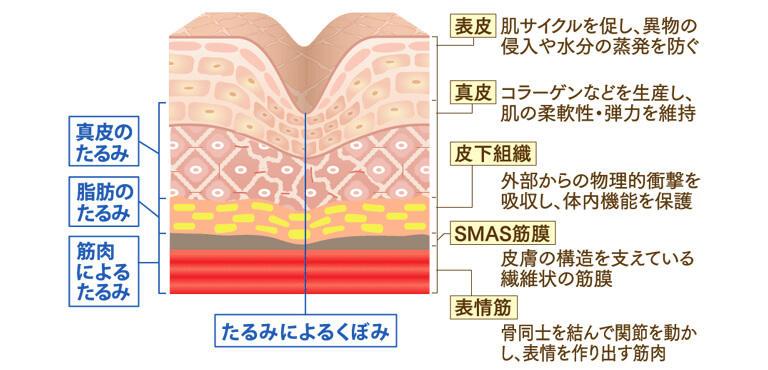 年齢とともに肌老化や筋力低下が進行することで、皮膚や脂肪、筋膜などがゆるみ、下垂し「たるみ」となります。たるみの種類は皮膚構造と密接な関係があり、皮膚の各層に応じて「真皮のたるみ」「脂肪のたるみ」「筋肉によるたるみ」「たるみによるくぼみ」の4つのタイプに分類されます。