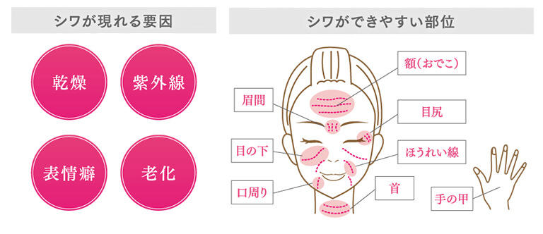 シワは、乾燥、紫外線、表情癖、老化がなどが要因で現れます。額、眉間、目尻や目の下、ほうれい線、口周り、首、手の甲にできやすいとされています。