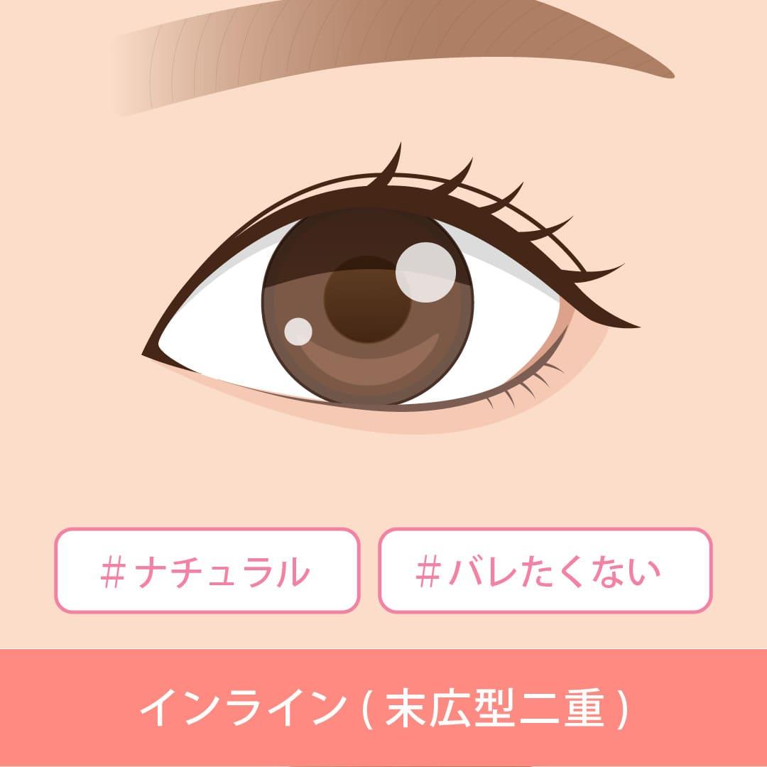 eye-correction_contents_01_02.jpg