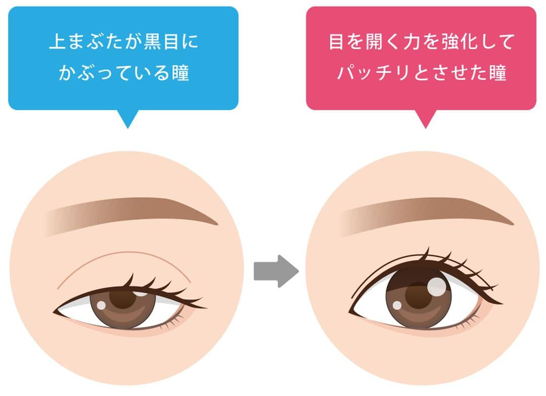 eye-correction_contents_04_02.jpg