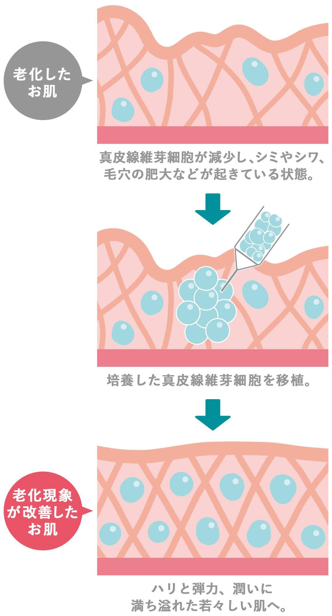 img-sp_regenerative-skin-treatment-unique-01.jpg