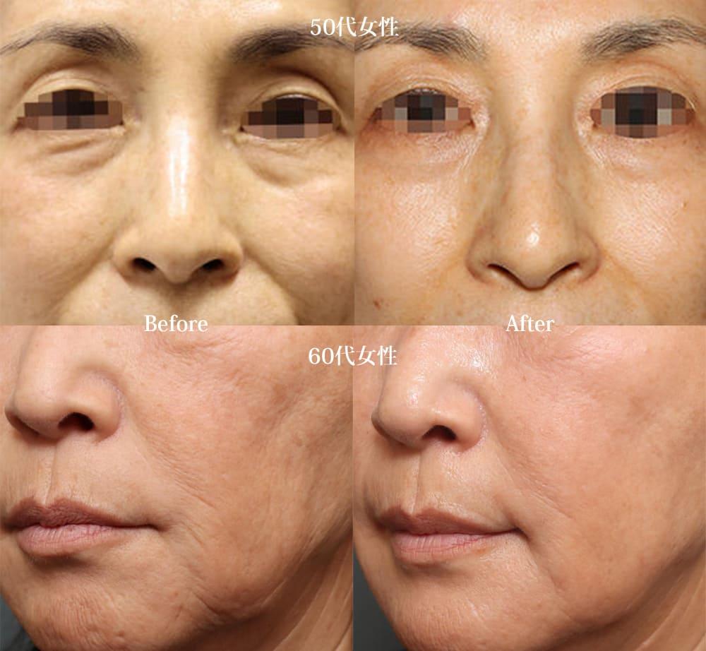 img-sp_regenerative-skin-treatment-unique-02.jpg