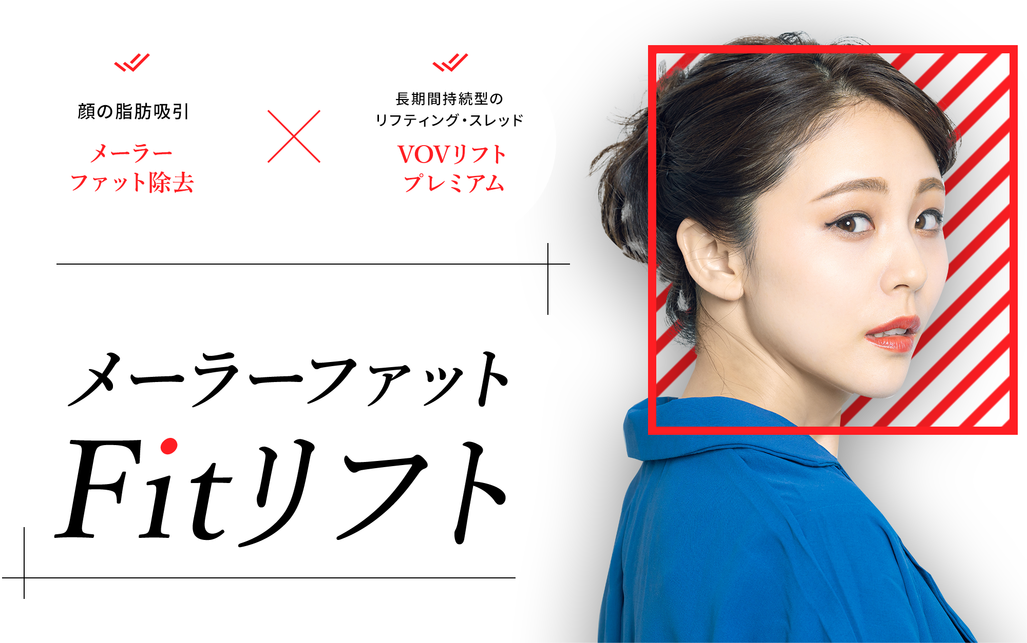 笑った時の頬肉が気になる方へ メーラーファットFitリフト