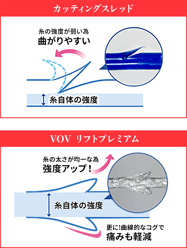 糸の特徴