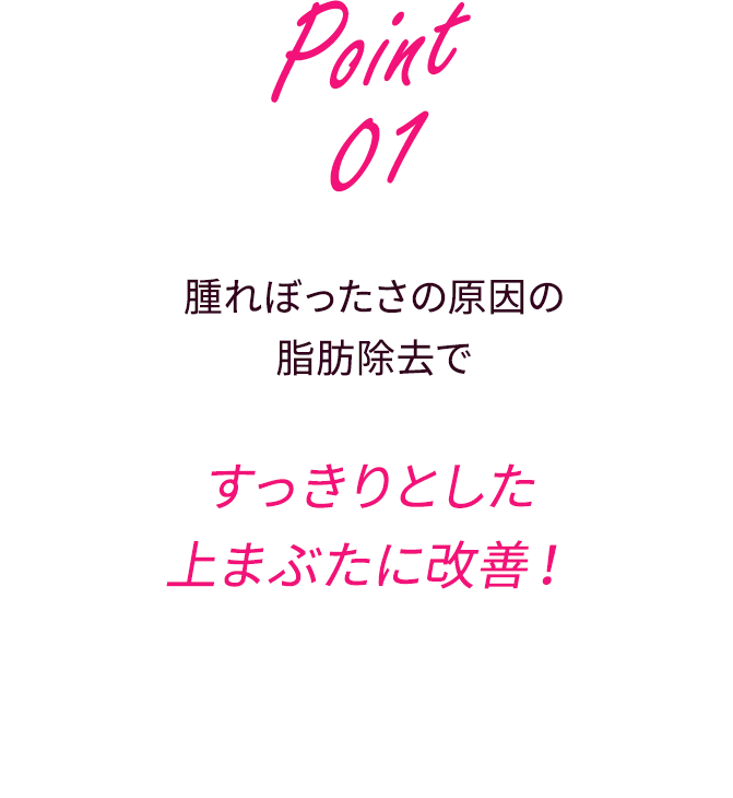 腫れぼったさの原因の脂肪除去ですっきりとした上まぶたに改善！